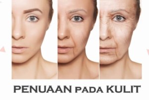 Penyaan kulit