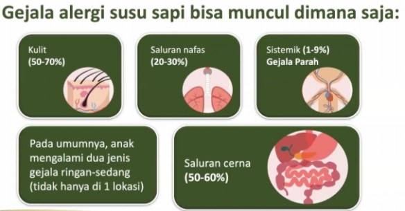 Alergi susu sapi